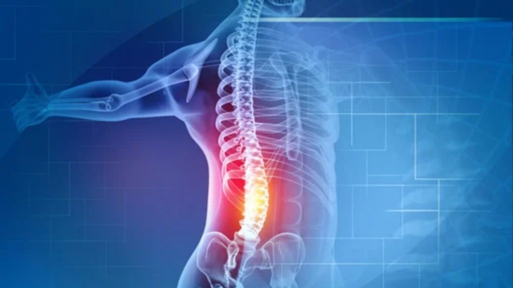 Common Symptoms of Disc Problem