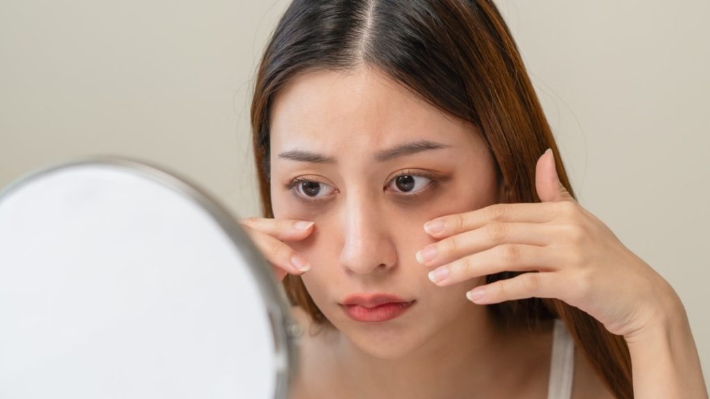 Jeevan Ayurveda में डार्क सर्कल का इलाज