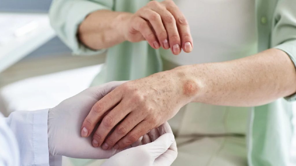 Autoimmune Disease क्या है